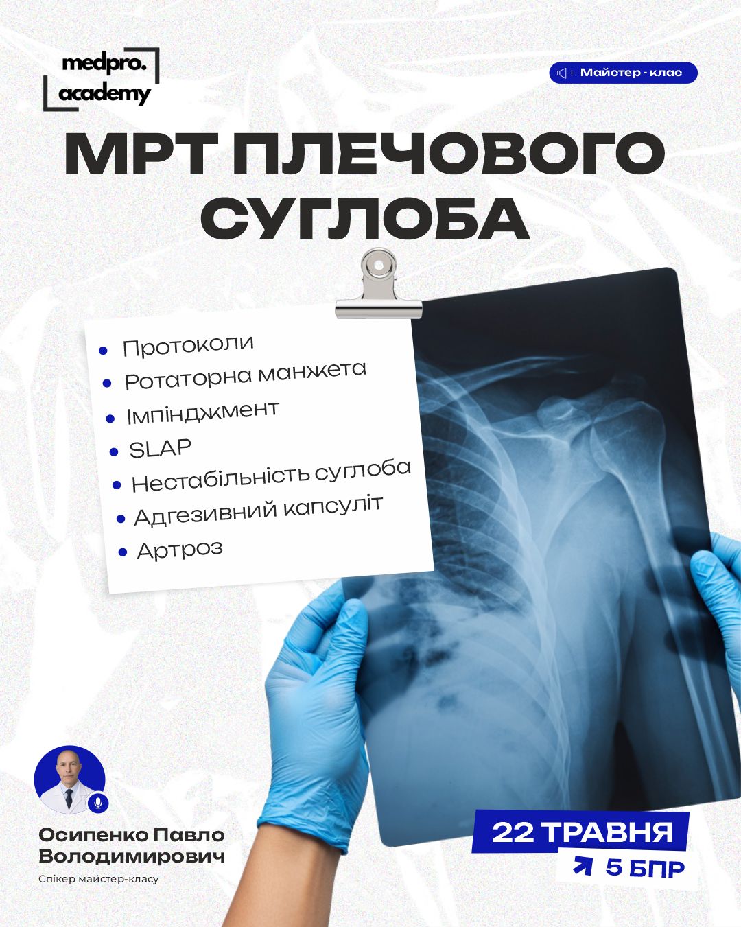 3МРТ плечового суглоба